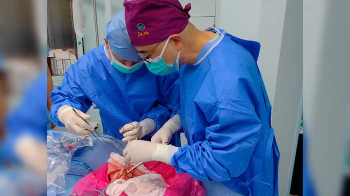 China: realizaron un trasplante de pulmón de cerdo en un paciente de 39 años