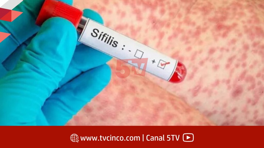 AUMENTARON LOS CASOS DE SÍFILIS EN JÓVENES: LOS CONTAGIOS CRECIERON 71%